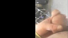 My story of penile enlargement surgery for girth and length at 8495