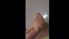 My story of penile enlargement surgery for girth and length at 8495