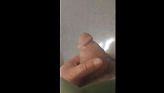 My story of penile enlargement surgery for girth and length at 8495