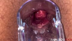 i'm using a speculum to show my gaping anal hole