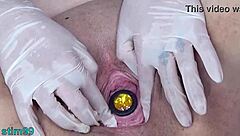 The German woman has a catheter in the cervix and it is filled with air