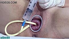German Cervix Stretching With Catheter Inflation Uterus