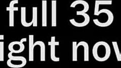 African Nurse Cosplay Sucks Big Cock In Casting!