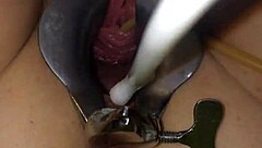 Extreme gyno play with needle on cervix during exam