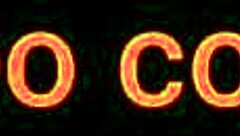 fanny goes to the doctor to show her ass